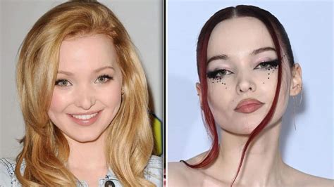 dove camerons plastic surgery|Dove Cameron, Before and After .